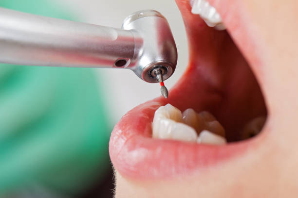 Best Tooth Infection Emergency Dentist  in Key Largo, FL